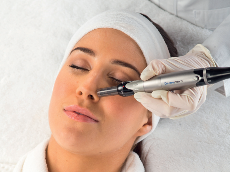 Dermapen, usuwanie blizn, zabiegi, dr marusza