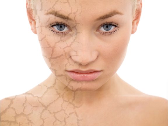 peeling lekarski TCA, peeling chemiczny, dr Marusza, Warszawa